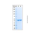 Recombinant Human Serpin B3/SSCA1 Protein