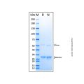 Recombinant Human Lck Protein