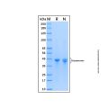 Recombinant Human Doublecortin Protein