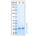 Recombinant Human ALK/CD246 Protein