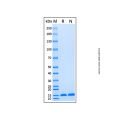 Recombinant Human ABCB1 Protein