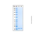 Recombinant Human ABL1 Protein
