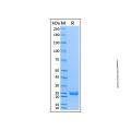 Recombinant Human Serum Albumin Protein