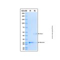 Recombinant Human Factor VIII Protein