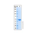 Recombinant Human Mre11 Protein