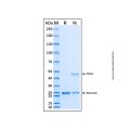 Recombinant Human BRAF Protein
