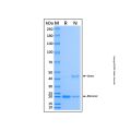Recombinant Human DNMT3A Protein