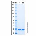 Recombinant Human HDAC4 Protein