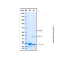 Recombinant Human EMR1 Protein