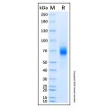 Recombinant Human IL-7R alpha/CD127 Protein