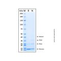 Recombinant Human CYP24A1 Protein