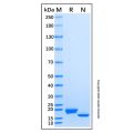 Recombinant Human IFN-alpha 4/IFNA4 Protein