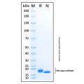 Recombinant Human IFN-alpha 6/IFNA6 Protein