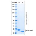 Recombinant Human IFN-alpha 7/IFNA7 Protein