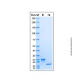 Recombinant Human IFN-alpha B2/IFNA8 Protein