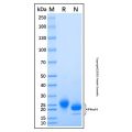 Recombinant Human IFN-alpha H2/IFNA14 Protein