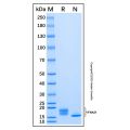 Recombinant Human IFN-alpha 21/IFNA21 Protein
