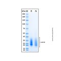 Recombinant Human Activin RIIB Protein