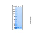Recombinant Human IL-21 Protein