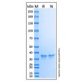 Recombinant Protein G