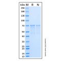 Recombinant Human AKT1 Protein