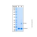 Recombinant Human Superoxide Dismutase 1 Protein
