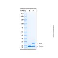 Recombinant Human AQP4 Protein