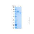 Recombinant Human CD21 Protein