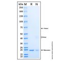 Recombinant Human Sonic Hedgehog/Shh (C24II) Protein