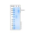 Recombinant Human NGFR/TNFRSF16 Protein