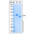 Recombinant Mouse MMP-2 Protein