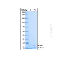 Recombinant Human PF4V1 Protein