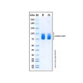 Recombinant Human CNTFR/CNTF Complex Protein