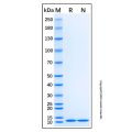 Recombinant Human SAA1 Protein