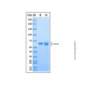 Recombinant Photinus pyralis Luciferase Protein