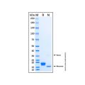 Recombinant Human IFN-alpha H2/IFNA14 Protein