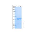 重组人RAD23A泛素结合蛋白