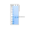 重组p62泛素结合蛋白