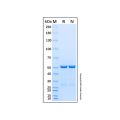 重组Ubiquilin-1泛素结合蛋白