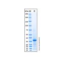 Recombinant D. pteronyssinus Peptidase 1/DERP1 Protein
