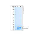 Recombinant Human GITR Ligand/TNFSF18 Protein