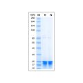 Recombinant Human TAGLN/Transgelin Protein