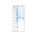Recombinant Human Transferrin Protein 