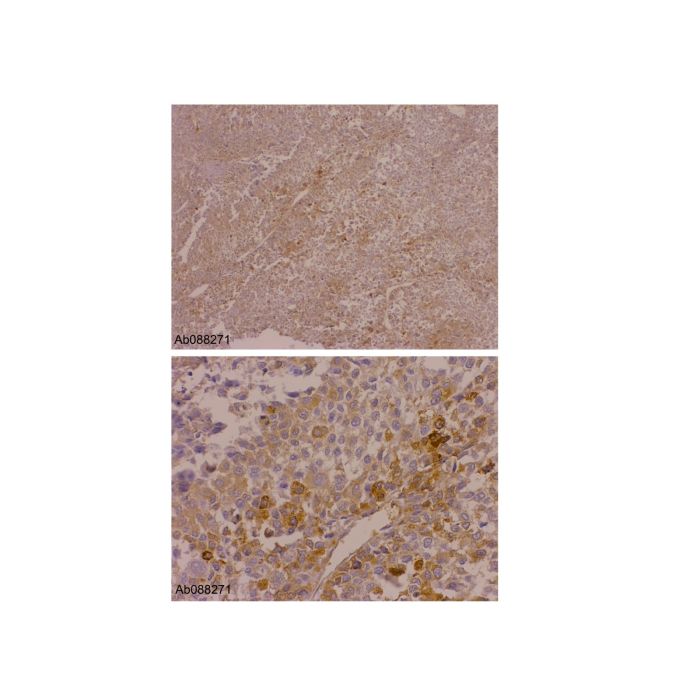 Recombinant alpha 1 Fetoprotein Antibody