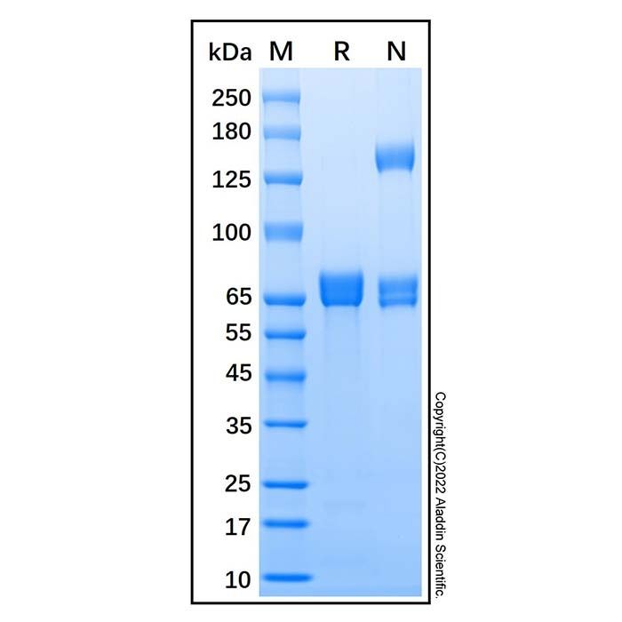 Recombinant Human Acetylcholinesterase/ACHE Protein