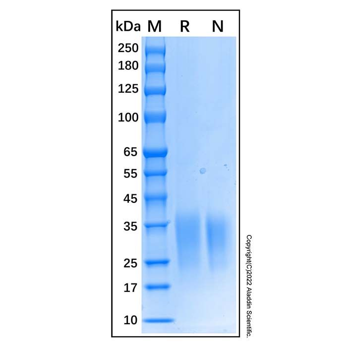 Recombinant Human Activin RIIA Protein