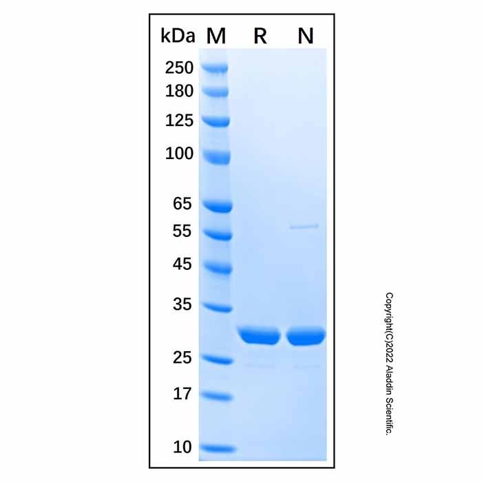 Recombinant Human Carbonic Anhydrase I Protein