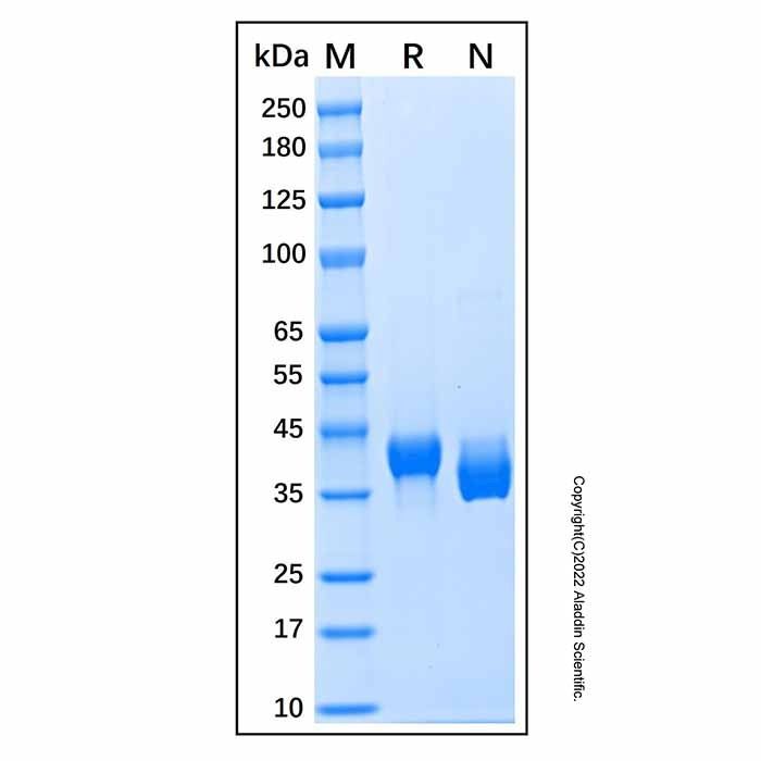 Recombinant Human Carbonic Anhydrase XIV Protein