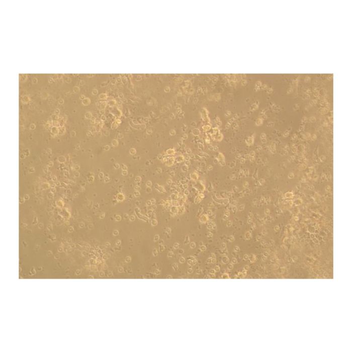 Recombinant Human CD83 Protein