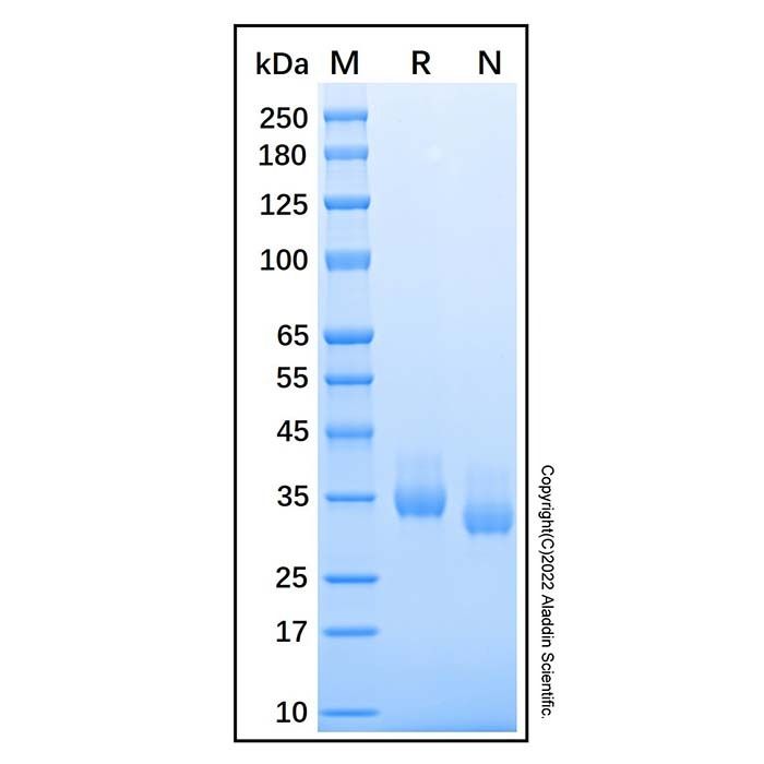 Recombinant Human Chymotrypsin C/CTRC Protein